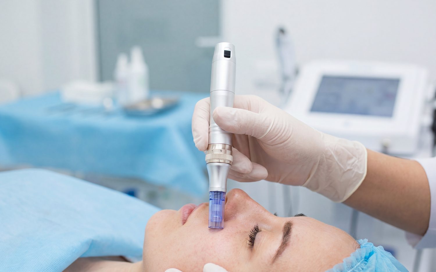 Microneedling